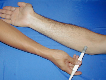 Musculoskeletal Ultrasound - Lommell Chiropractic: Accident, Injury